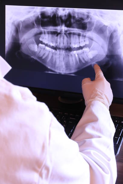 Best Teeth Whitening  in Vidor, TX